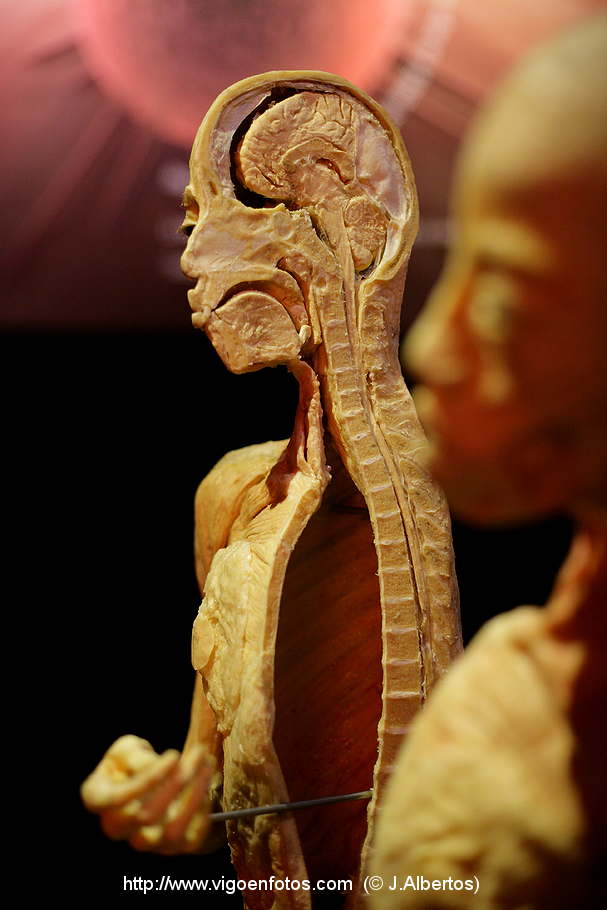 PHOTOS OF PLASTINATION EXHIBITION. ANATOMY - VIGO BAY. GALICIA. VISIT