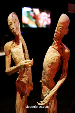 PLASTINATION EXHIBITION. ANATOMY