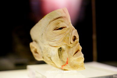 PLASTINATION EXHIBITION. ANATOMY