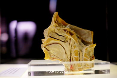 PLASTINATION EXHIBITION. ANATOMY