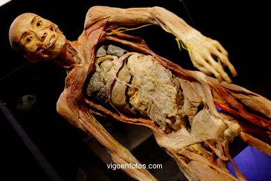 ANATOMÍA Y CUERPOS HUMANOS. PLASTINACIÓN: ÉRASE UNA VEZ LA VIDA. LA EXPOSICIÓN VIGO. 2009