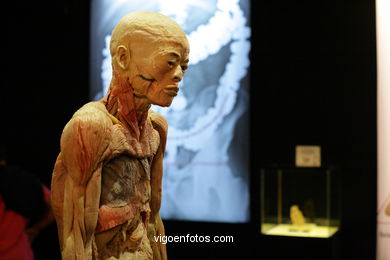 ANATOMÍA Y CUERPOS HUMANOS. PLASTINACIÓN: ÉRASE UNA VEZ LA VIDA. LA EXPOSICIÓN VIGO. 2009