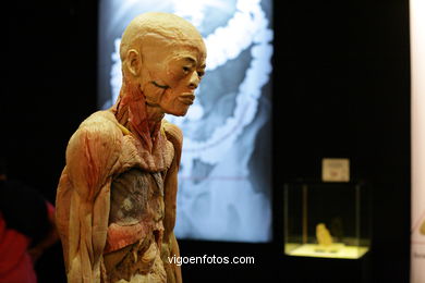 PLASTINATION EXHIBITION. ANATOMY