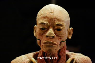 PLASTINATION EXHIBITION. ANATOMY