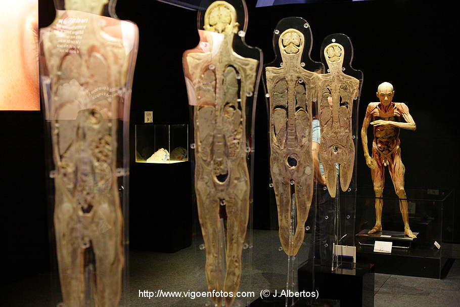 PHOTOS OF PLASTINATION EXHIBITION. ANATOMY VIGO BAY. GALICIA. VISIT